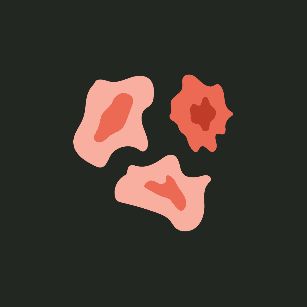 Minimal residual disease